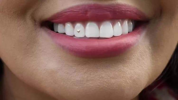 Open Wide Poster