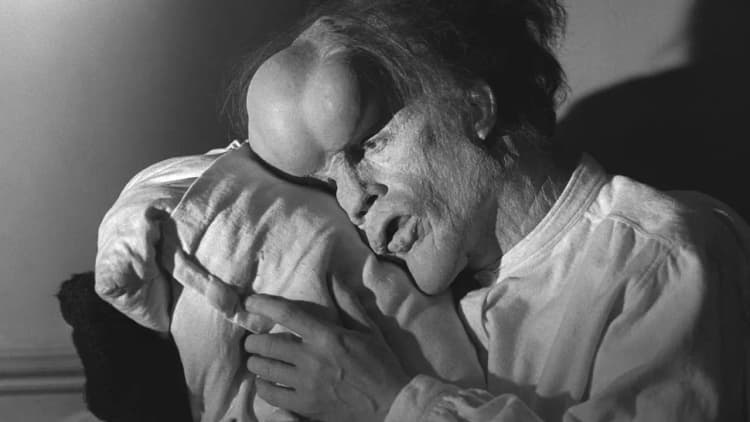 The Elephant Man Poster
